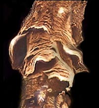 Cheveu grossi 500 fois au microscope &eacute;lectronique